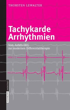 Tachykarde Arrhythmien (eBook, PDF) - Lewalter, Thorsten