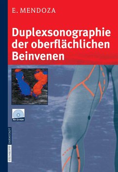 Duplexsonographie der oberflächlichen Beinvenen (eBook, PDF) - Mendoza, Erika