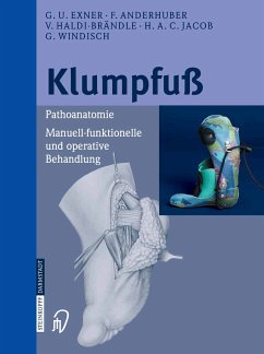 Klumpfuß (eBook, PDF) - Exner, G.U.; Anderhuber, F.; Haldi-Brändle, V.; Jacob, H. A.C.; Windisch, G.