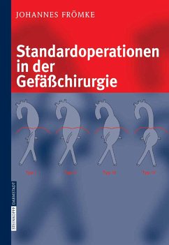 Standardoperationen in der Gefäßchirurgie (eBook, PDF) - Frömke, Johannes