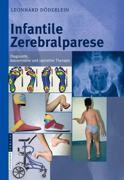 Infantile Zerebralparese (eBook, PDF) - Döderlein, L.