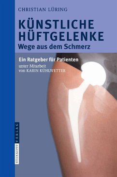 Künstliche Hüftgelenke (eBook, PDF) - Lüring, C.