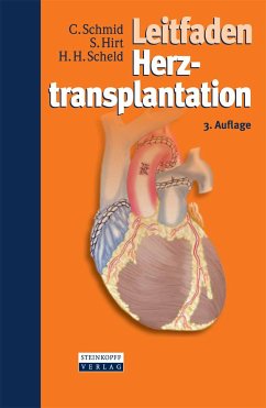 Leitfaden Herztransplantation (eBook, PDF) - Schmid, Christof; Hirt, Stephan; Scheld, Hans Heinrich