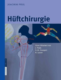 Hüftchirurgie (eBook, PDF) - Pfeil, Joachim