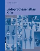 Endoprothesenatlas Knie (eBook, PDF)