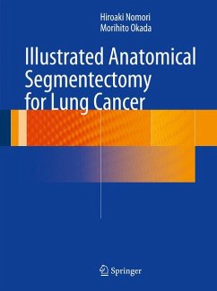 Illustrated Anatomical Segmentectomy for Lung Cancer (eBook, PDF) - Nomori, Hiroaki; Okada, Morihito
