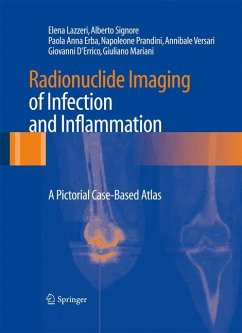 Radionuclide Imaging of Infection and Inflammation (eBook, PDF) - Lazzeri, Elena; Signore, Alberto; Erba, Paola Anna; Prandini, Napoleone; Versari, Annibale; D´Errico, Giovanni; Mariani, Giuliano