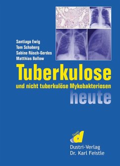 Cover Tuberkulose und nicht tuberkulöse Mykobakteriosen heute (eBook, PDF)