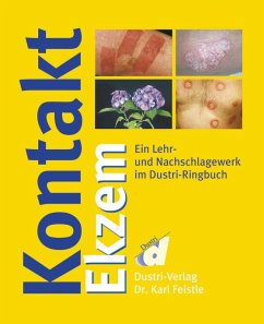Cover Kontaktekzem (eBook, PDF)