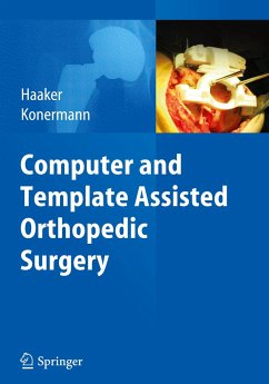 Computer and Template Assisted Orthopedic Surgery