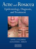 Acne and Rosacea (eBook, PDF)