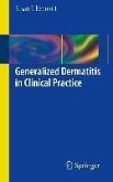Generalized Dermatitis in Clinical Practice (eBook, PDF)