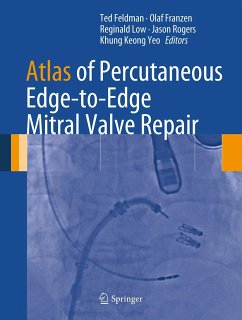 Atlas of Percutaneous Edge-to-Edge Mitral Valve Repair (eBook, PDF)
