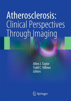 Atherosclerosis: Clinical Perspectives Through Imaging (eBook, PDF)