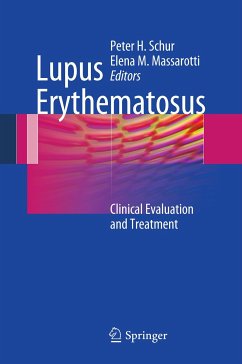Lupus Erythematosus (eBook, PDF)