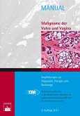 Malignome der Vulva und Vagina (eBook, PDF)