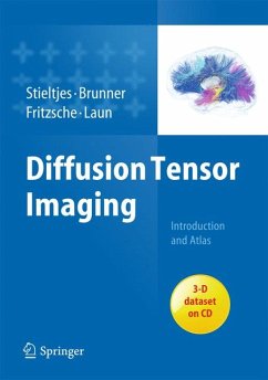 Diffusion Tensor Imaging (eBook, PDF) - Stieltjes, Bram; Brunner, Romuald M.; Fritzsche, Klaus; Laun, Frederik