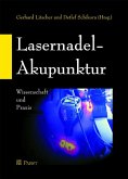 Lasernadel-Akupunktur (eBook, PDF)