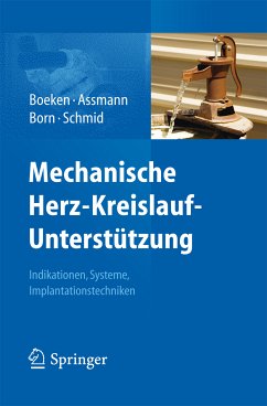 Mechanische Herz-Kreislauf-Unterstützung (eBook, PDF)