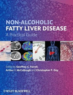 Non-Alcoholic Fatty Liver Disease (eBook, PDF)
