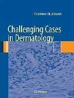 Challenging Cases in Dermatology (eBook, PDF) - El-Darouti, Mohammad Ali