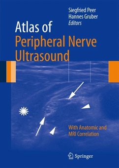 Atlas of Peripheral Nerve Ultrasound (eBook, PDF)