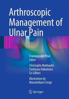 Arthroscopic Management of Ulnar Pain (eBook, PDF)