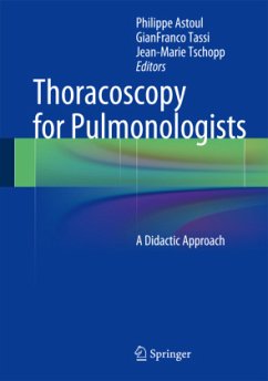 Thoracoscopy for Pulmonologists Thoracoscopy for Pulmonologists