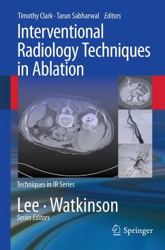 Interventional Radiology Techniques in Ablation (eBook, PDF)