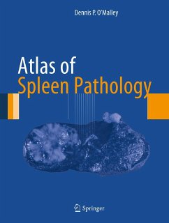 Atlas of Spleen Pathology (eBook, PDF) - O'Malley, Dennis P.