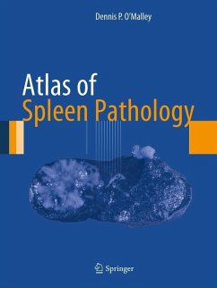 Atlas of Spleen Pathology (eBook, PDF) - O'Malley, Dennis P.