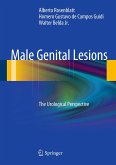 Male Genital Lesions (eBook, PDF)
