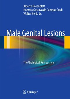 Male Genital Lesions (eBook, PDF) - Rosenblatt, Alberto; de Campos Guidi, Homero Gustavo; Belda Jr., Walter