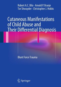 Cutaneous Manifestations of Child Abuse and Their Differential Diagnosis (eBook, PDF) - Bilo, Robert A.C.; Oranje, Arnold P.; Shwayder, Tor; Hobbs, Christopher J.