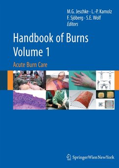 Handbook of Burns Volume 1 (eBook, PDF)