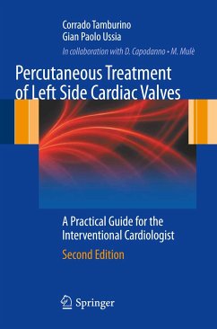 Percutaneous Treatment of Left Side Cardiac Valves (eBook, PDF) - Tamburino, Corrado; Ussia, Gian Paolo