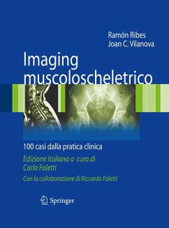 Imaging muscoloscheletrico (eBook, PDF) - Ribes, Ramón; Vilanova, Joan C.