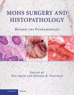 Mohs Surgery and Histopathology (eBook, ePUB)