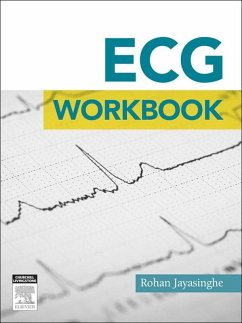 ECG workbook - E-Book (eBook, ePUB) - Jayasinghe, Rohan