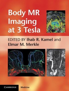 Body MR Imaging at 3 Tesla (eBook, ePUB)
