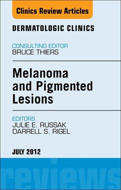 Melanoma and Pigmented Lesions, An Issue of Dermatologic Clinics (eBook, ePUB) - Russak, Julie E.; Rigel, Darrell S.