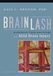 Brainlash (eBook, ePUB) - Bild 1