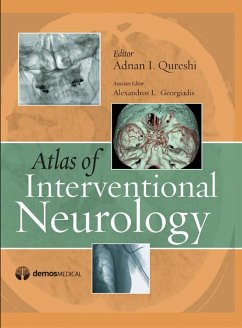 Cover Atlas of Interventional Neurology (eBook, PDF)