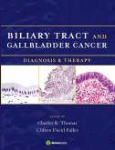 Biliary Tract and Gallbladder Cancer (eBook, ePUB)