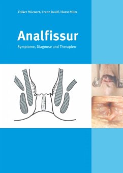 Cover Analfissur (eBook, ePUB)
