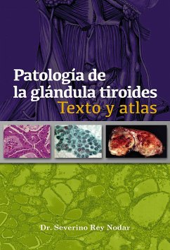 Patología de la glándula tiroides (eBook, ePUB) - Rey, Severino