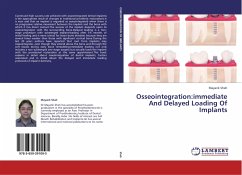 Osseointegration:immediate And Delayed Loading Of Implants - Shah, Mayank