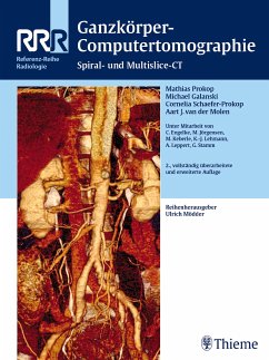 Ganzkörper-Computertomographie (eBook, PDF)