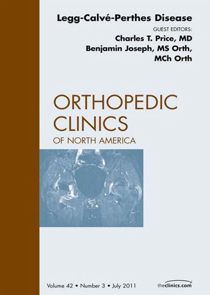 Perthes Disease, An Issue of Orthopedic Clinics (eBook, ePUB) Perthes Disease, An Issue of Orthopedic Clinics (eBook, ePUB)
