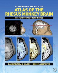 A Combined MRI and Histology Atlas of the Rhesus Monkey Brain in Stereotaxic Coordinates (eBook, PDF) - Saleem, Kadharbatcha S.; Logothetis, Nikos K.